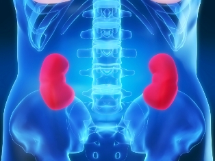 nomatch-kidney.jpg